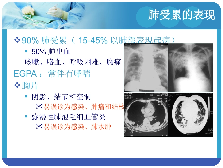 ANCA相关血管炎_第13页