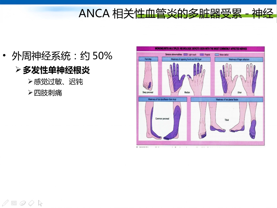 ANCA相关性血管炎诊断思路_第13页