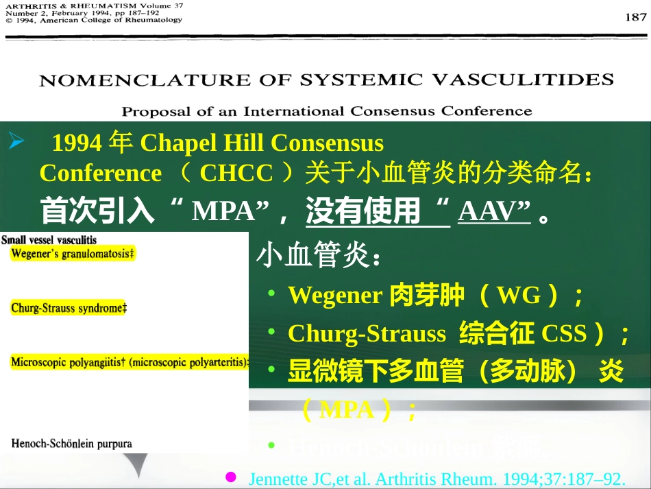 ANCA相关性血管炎的诊治进展 PPT_第13页
