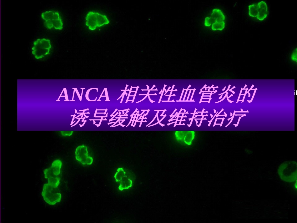 ANCA相关性血管炎的诱导缓解及维持治疗进展_第1页