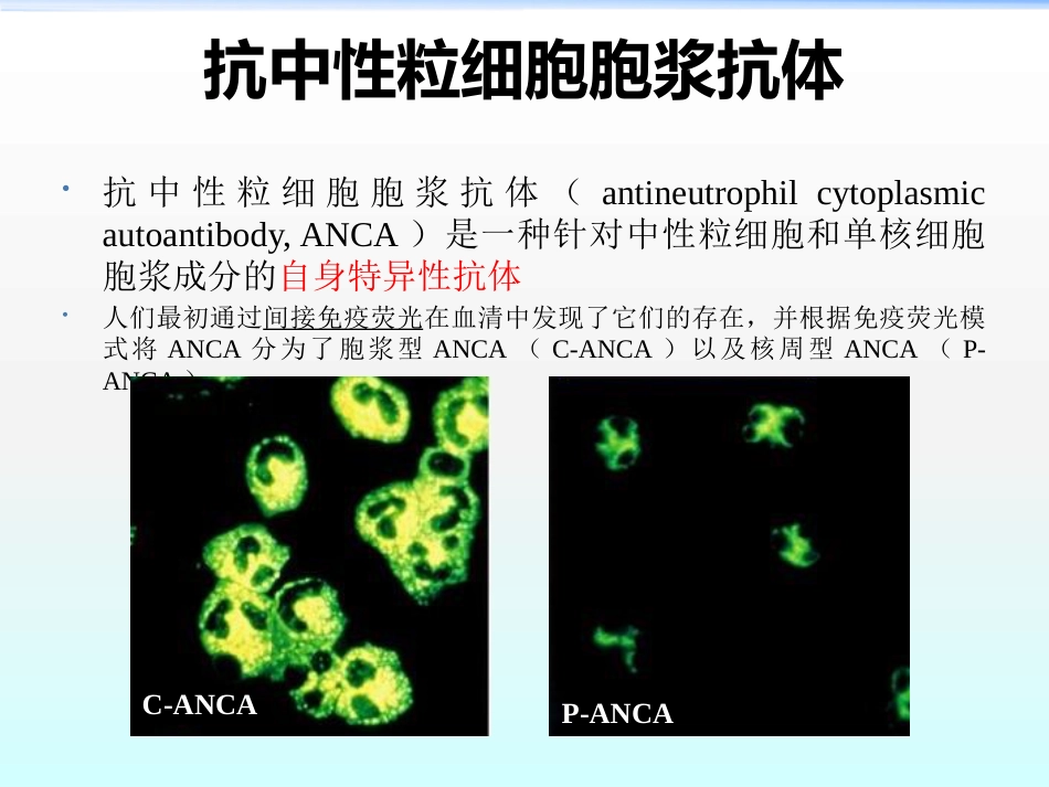 ANCA相关性血管炎ppt课件_第4页