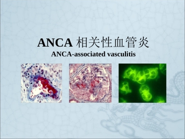 ANCA相关性血管炎ppt课件