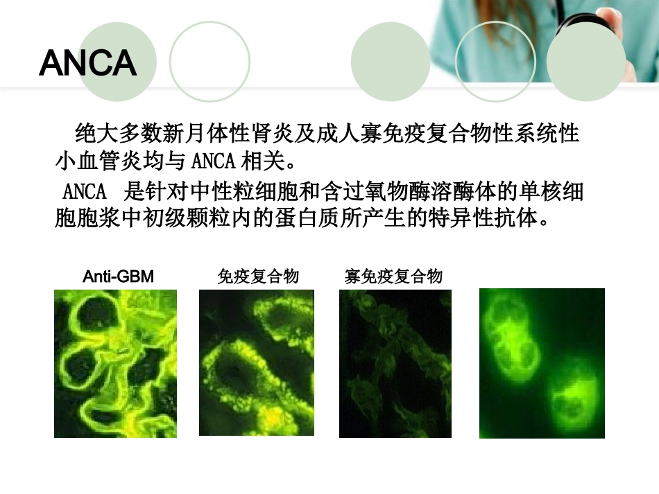 ANCA相关性血管炎PPT幻灯片_第11页