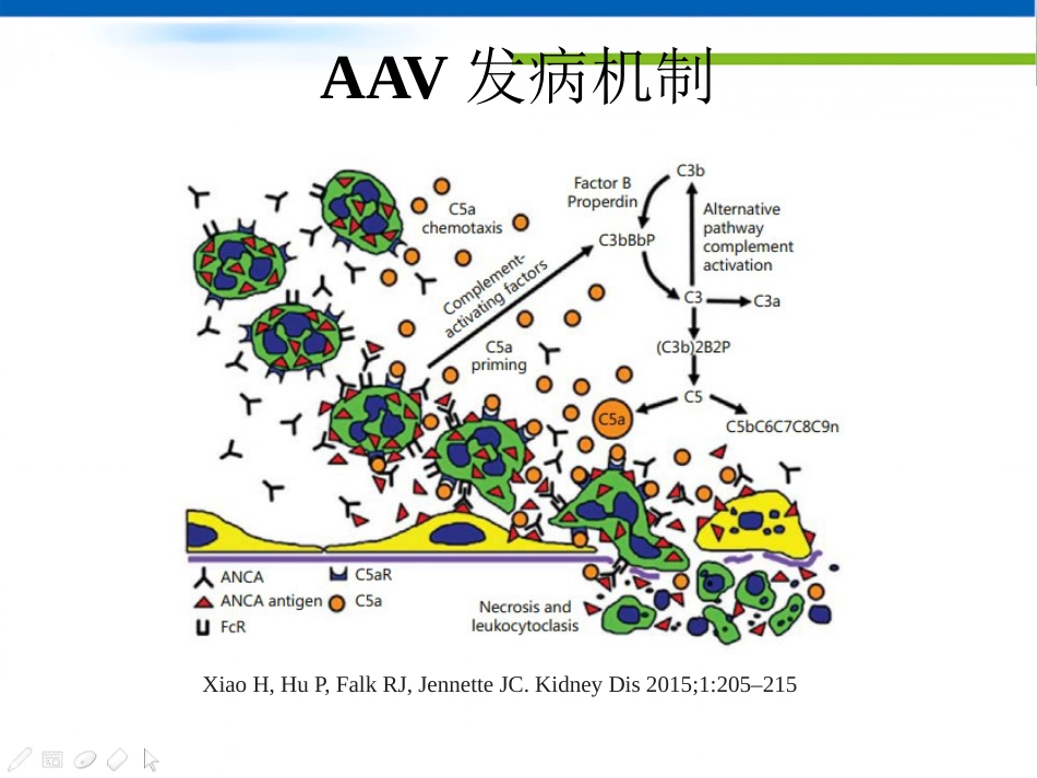 ANCA相关性血管炎(1)_第15页