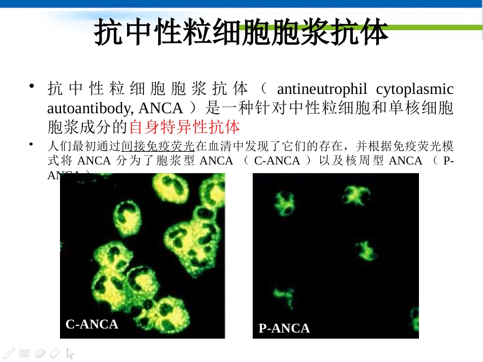 ANCA相关性血管炎(1)_第4页