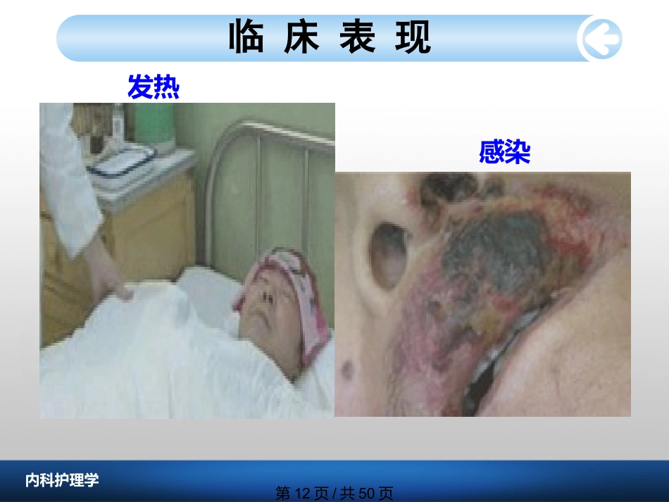 白血病病人护理_第12页