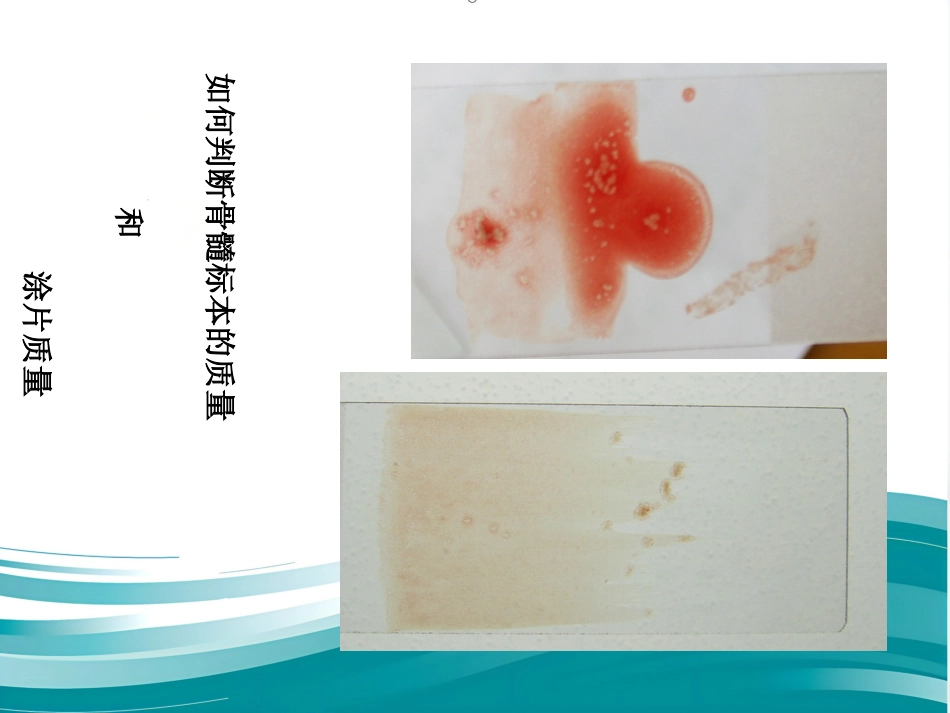 白血病化疗流程_第14页