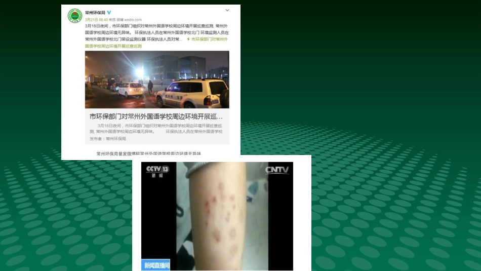 白血病医学ppt课件_第15页