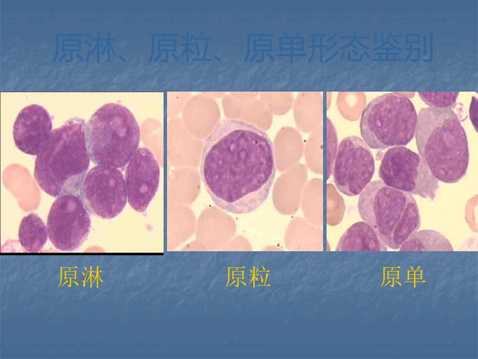 白血病的治疗_第14页