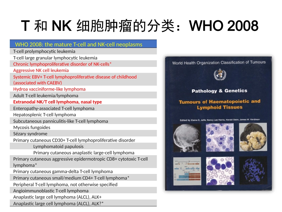 NKT细胞淋巴瘤周剑峰解读_第2页