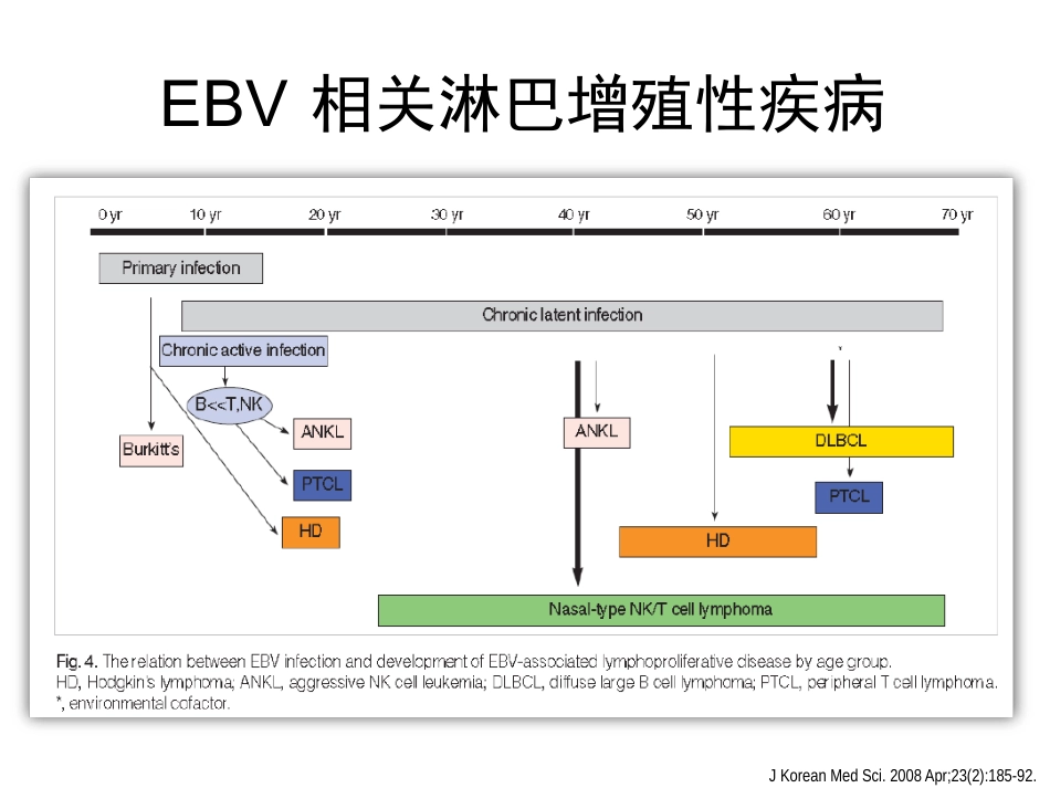 NKT细胞淋巴瘤周剑峰解读_第4页