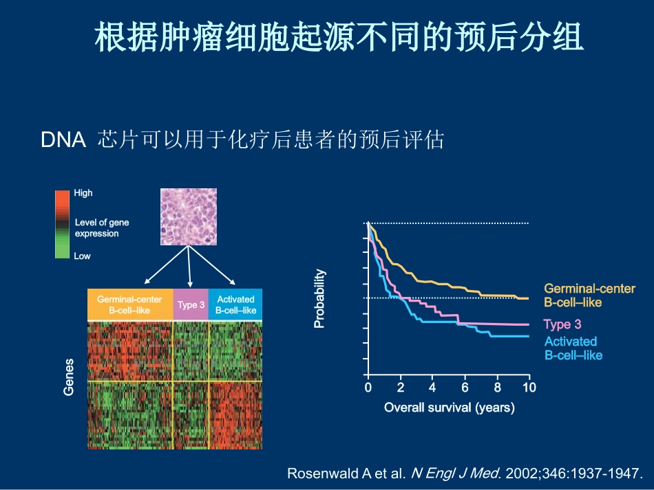 DLBCL FL 恶性淋巴瘤_第13页