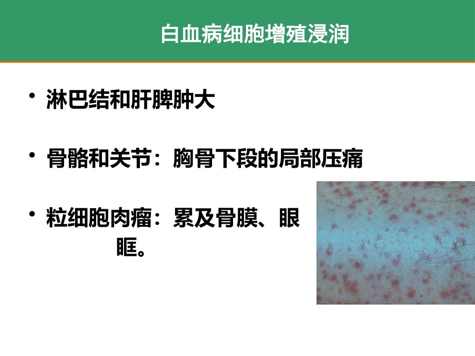 白血病_第15页