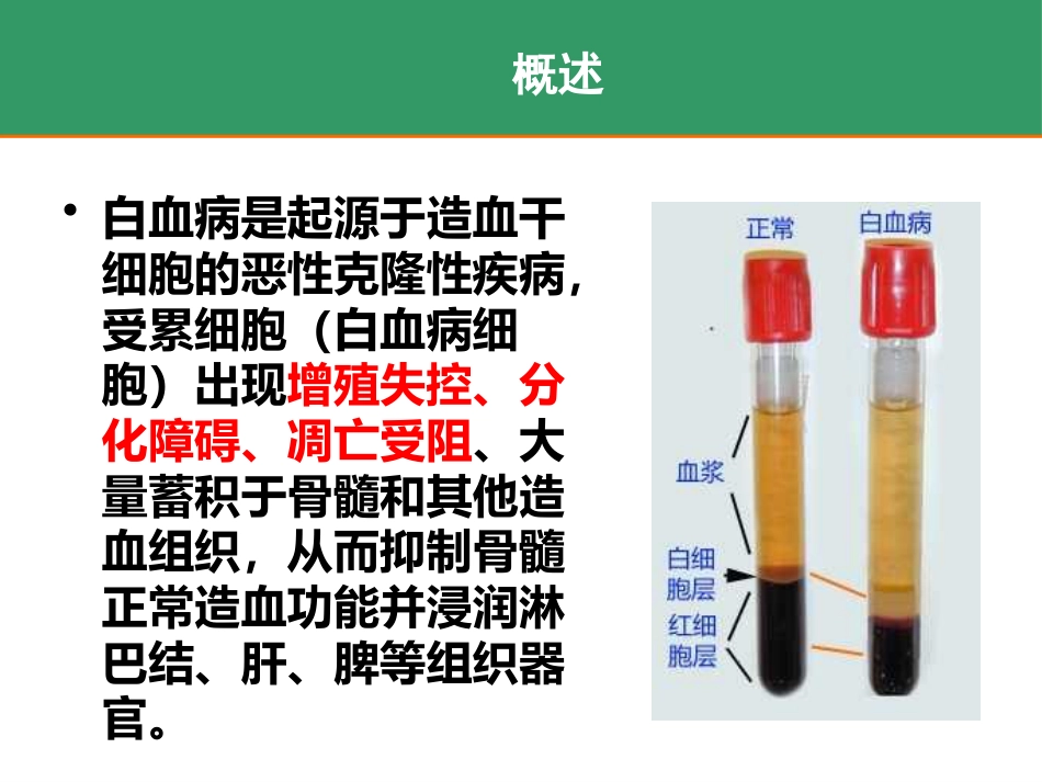 白血病_第2页