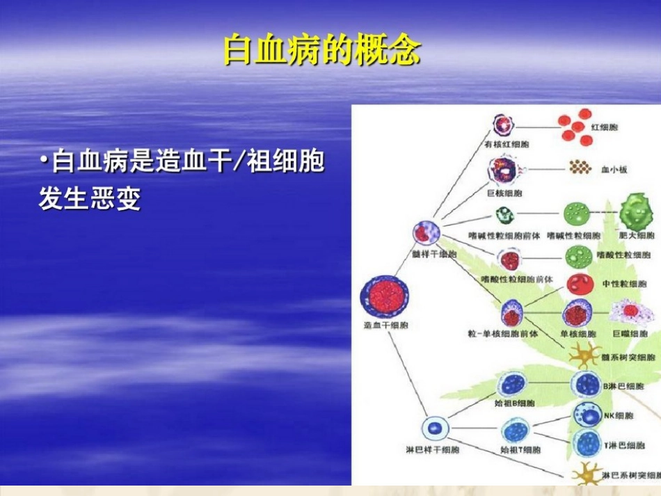 白血病的分型_第2页