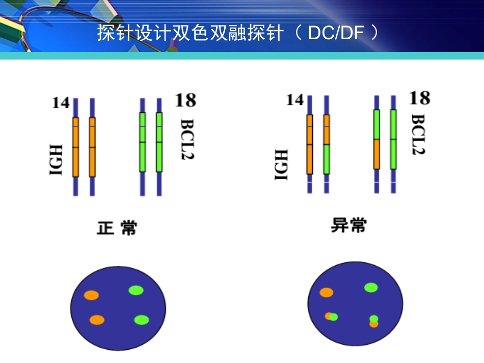 FISH在淋巴瘤诊治中的应用_第14页