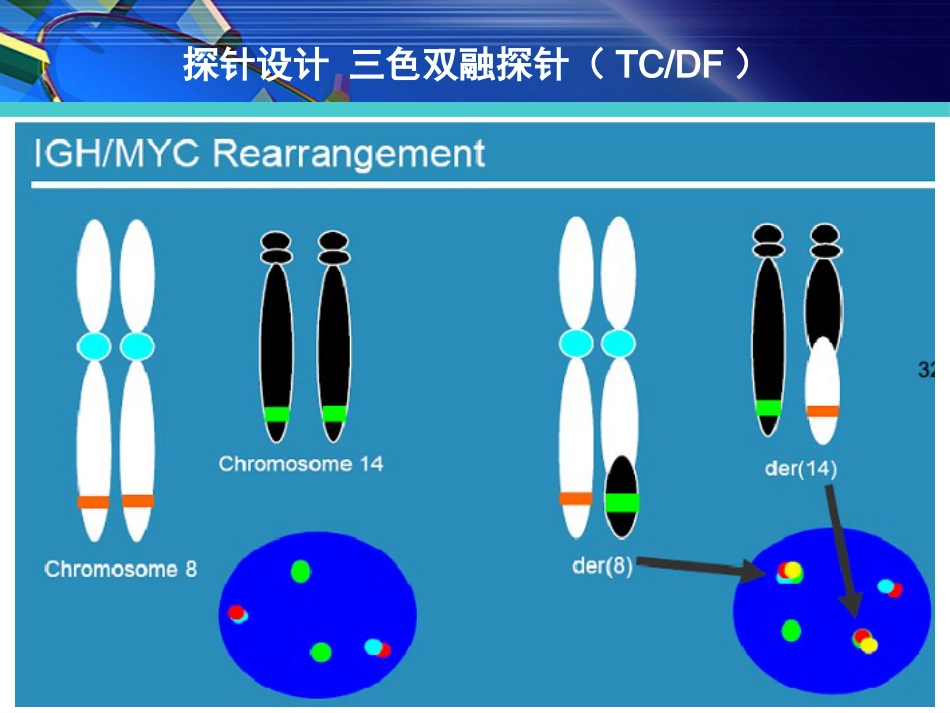FISH在淋巴瘤诊治中的应用_第15页