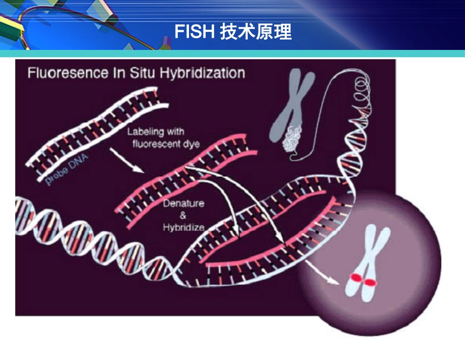 FISH在淋巴瘤诊治中的应用_第7页