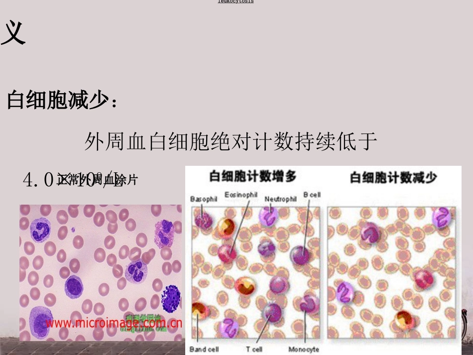 白细胞减少和粒细胞缺乏症(2)_第7页