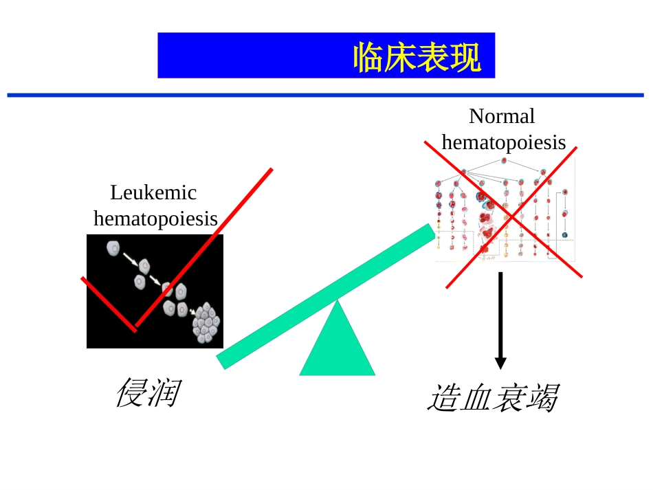 白血病(3)_第14页