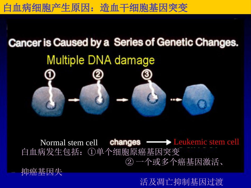 白血病(3)_第4页