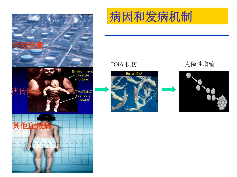 白血病(3)_第5页