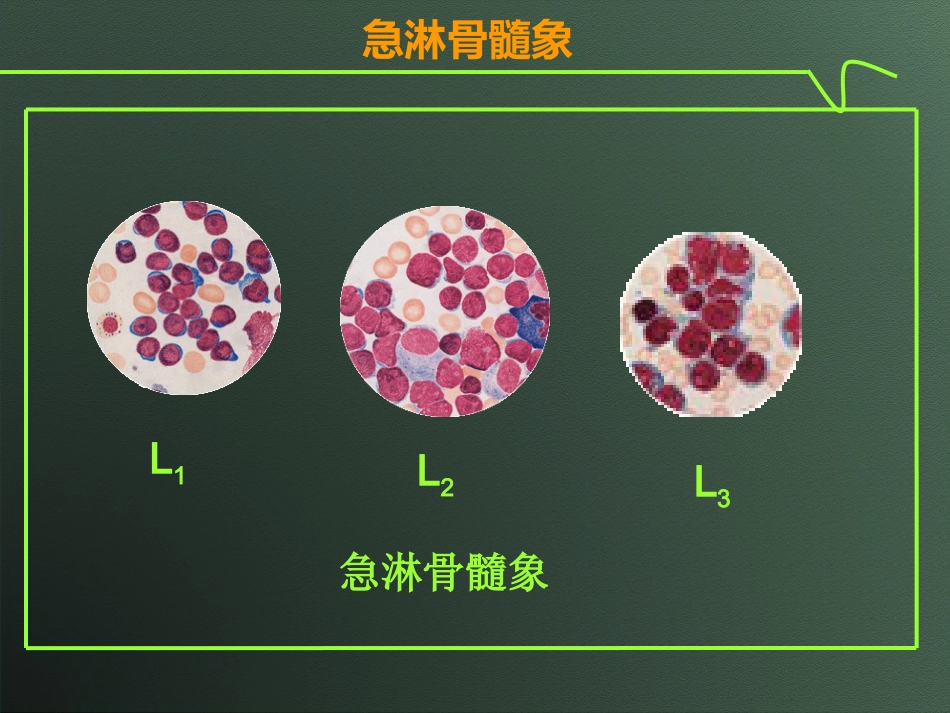 白血病(10)_第13页