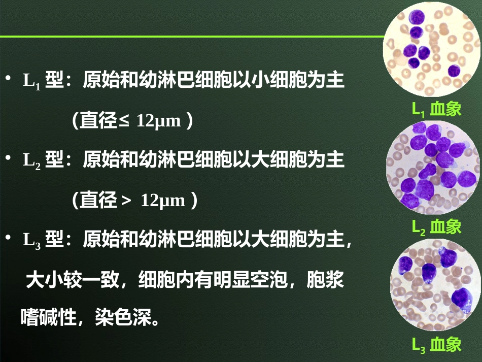 白血病(10)_第15页