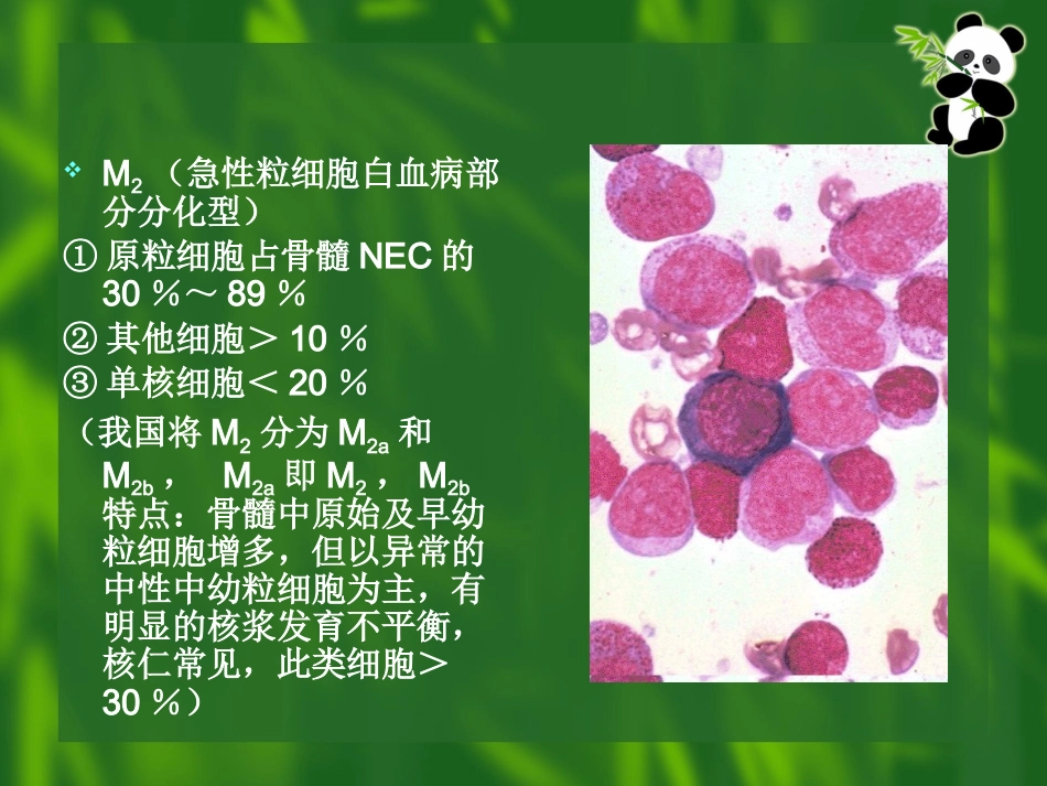 白血病(11)_第13页