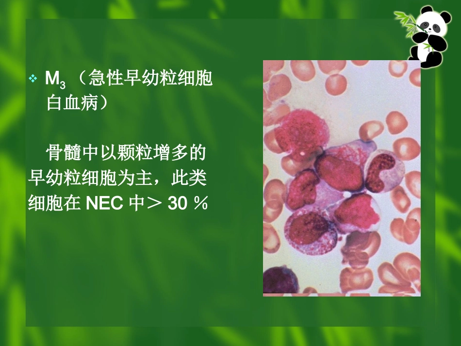 白血病(11)_第14页