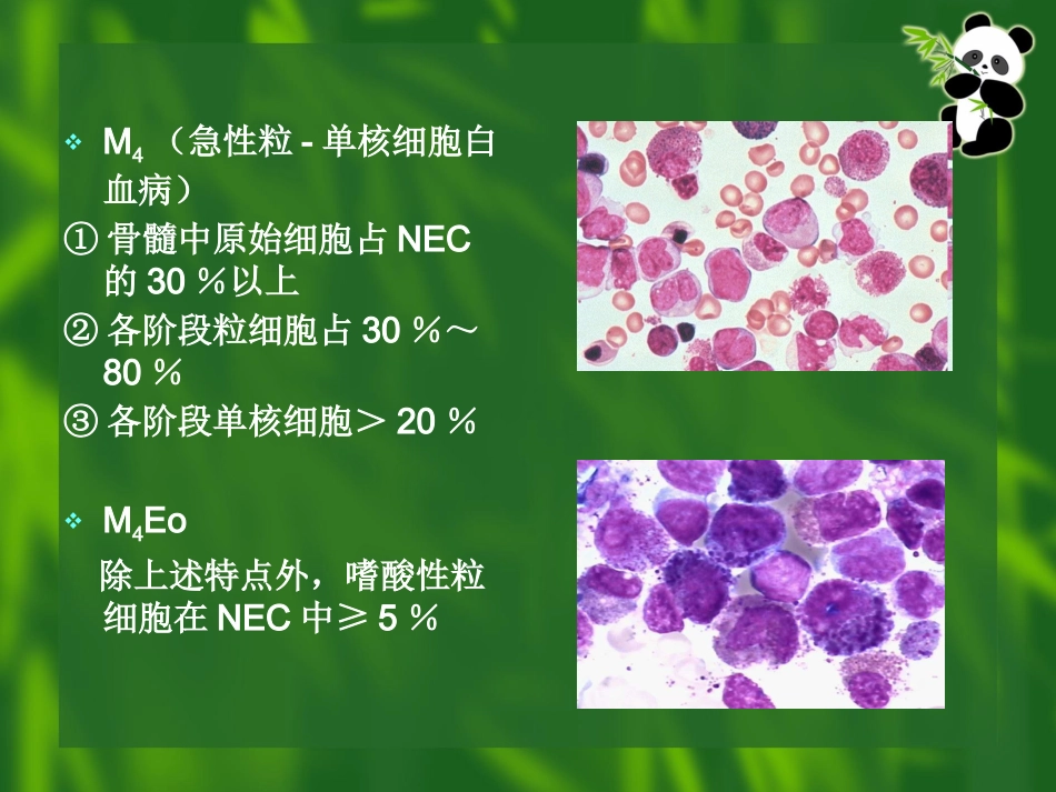 白血病(11)_第15页