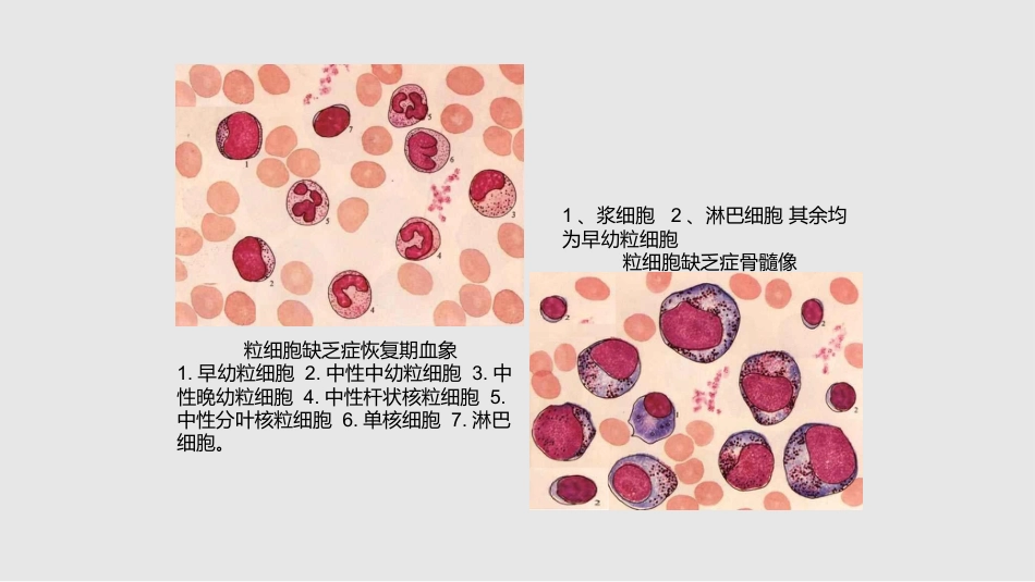 白细胞减少和粒细胞缺乏症11学习PPT教案_第9页