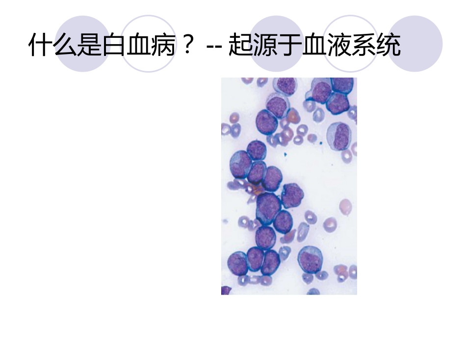 白血病(12)_第4页