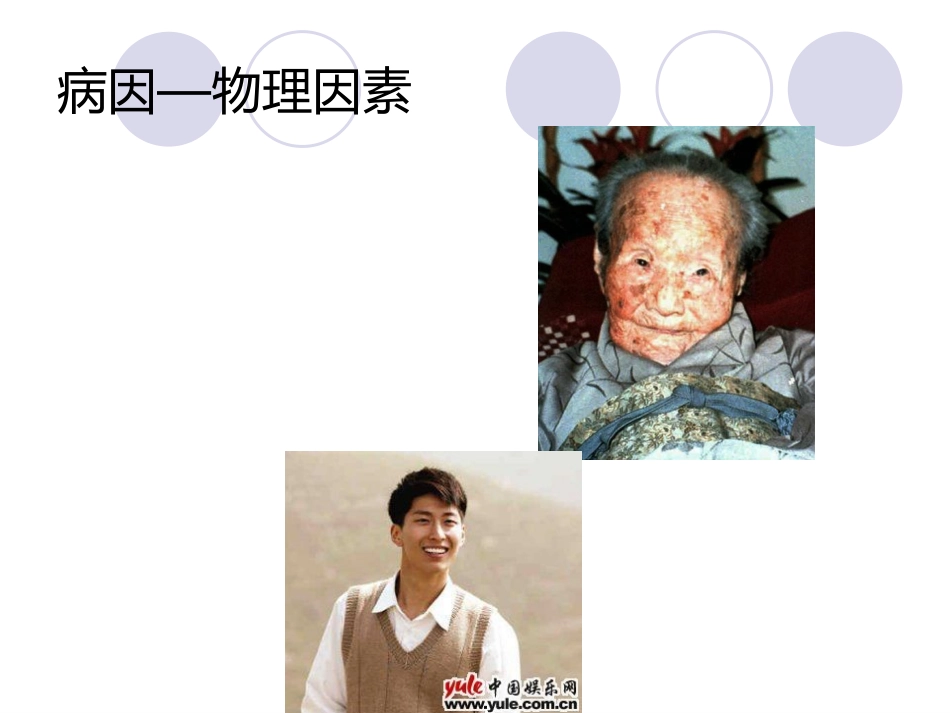 白血病(12)_第9页