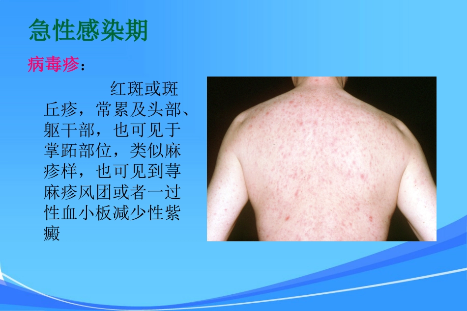 HIV皮肤与口腔表现_第3页
