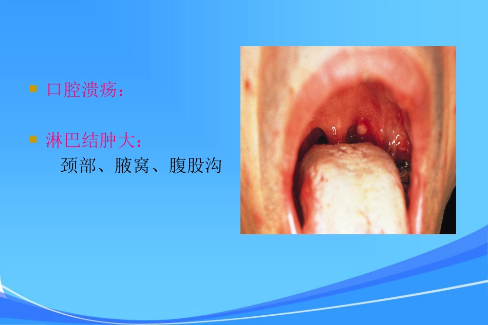 HIV皮肤与口腔表现_第4页