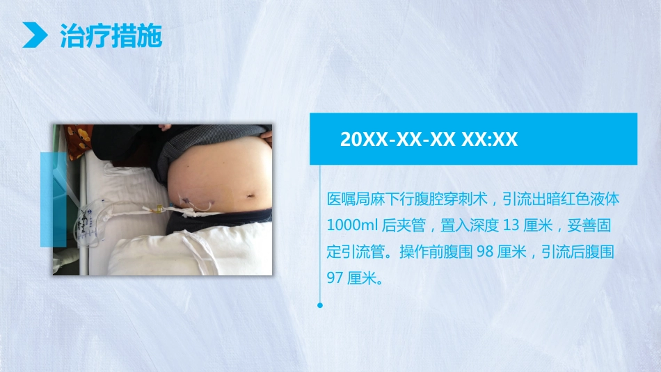 肺癌护理个案体会_第15页