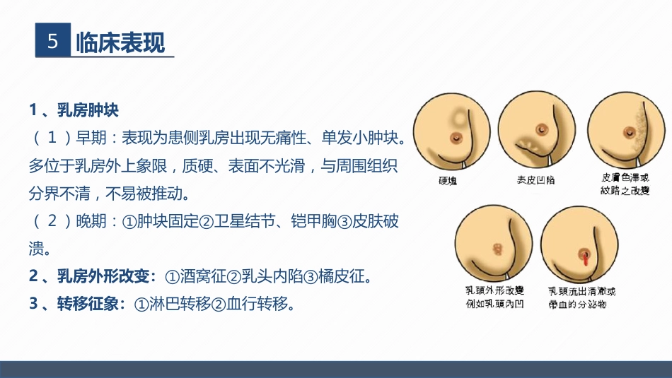 肿瘤内科-乳腺癌患者术后护理查房_第10页