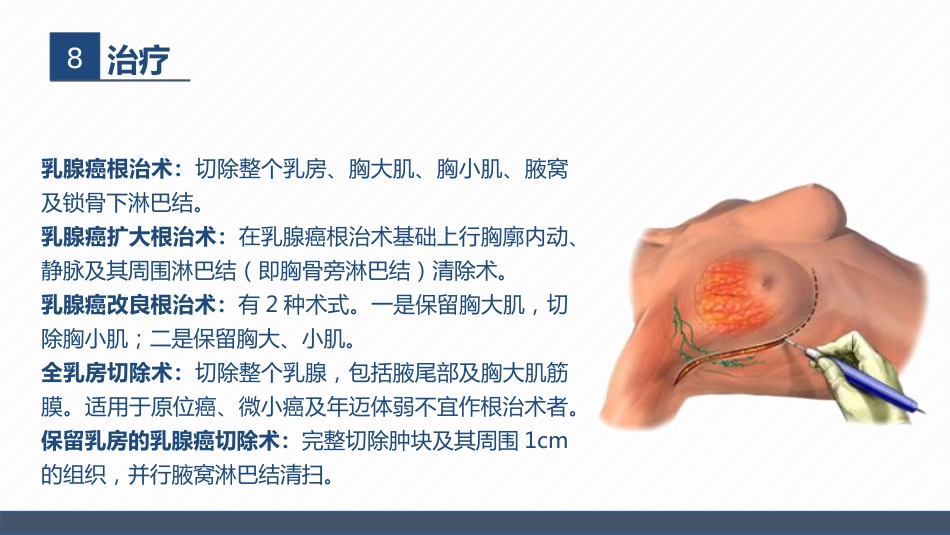 肿瘤内科-乳腺癌患者术后护理查房_第14页