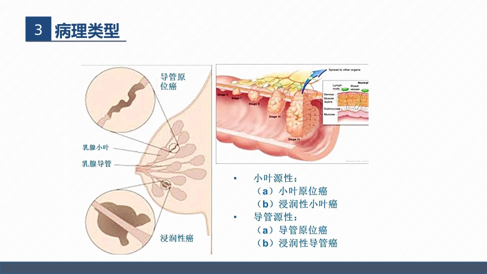 肿瘤内科-乳腺癌患者术后护理查房_第7页
