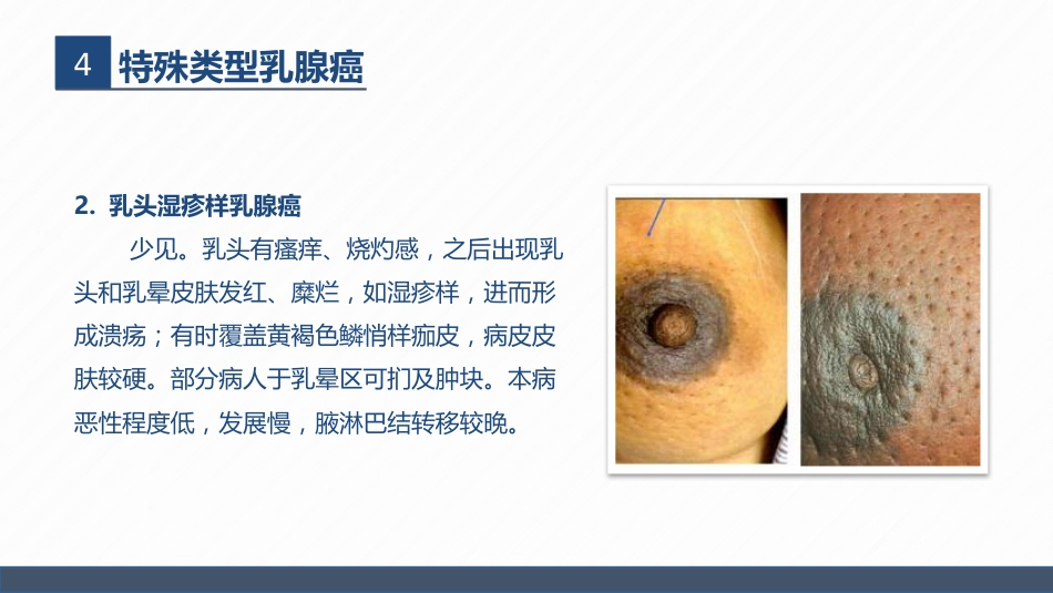 肿瘤内科-乳腺癌患者术后护理查房_第9页