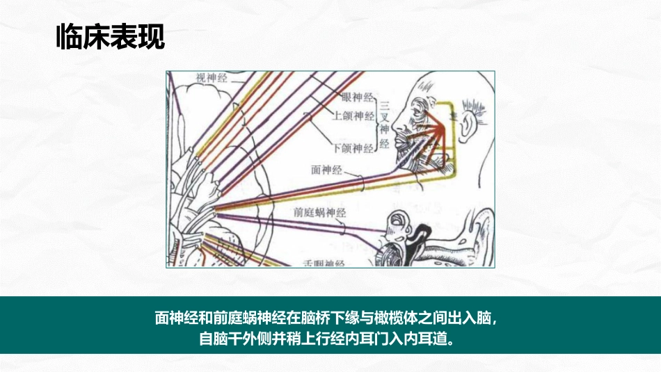 小脑肿瘤术后护理查房_第10页