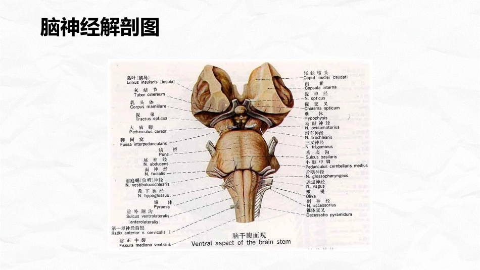 小脑肿瘤术后护理查房_第6页