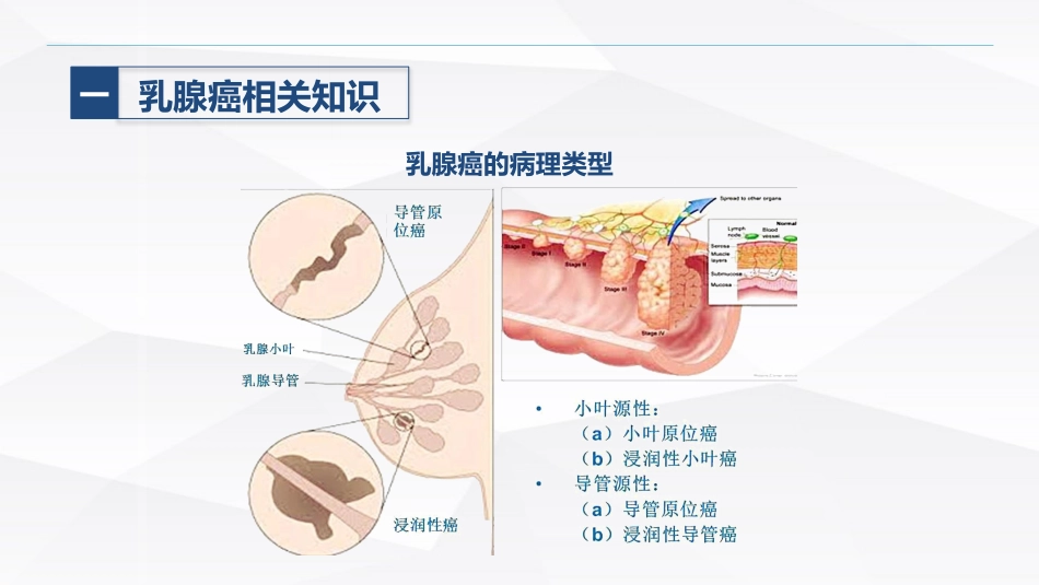 乳腺癌的护理_第7页
