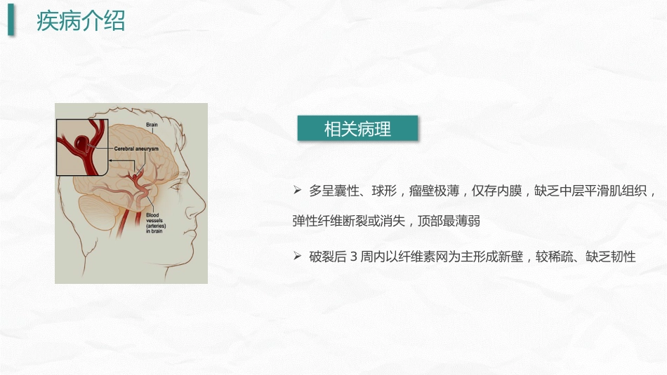 颅内动脉瘤护理_第12页