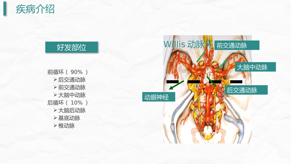 颅内动脉瘤护理_第8页