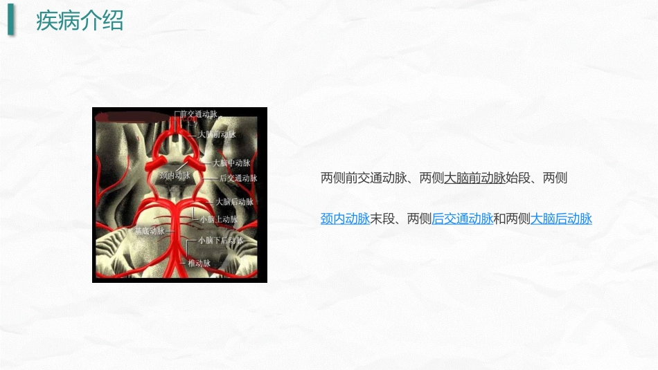 颅内动脉瘤护理_第9页
