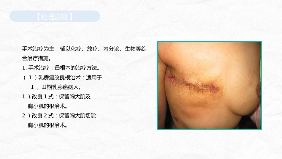 乳腺癌护理查房_第10页