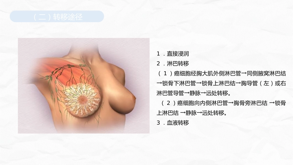 乳腺癌护理查房_第6页