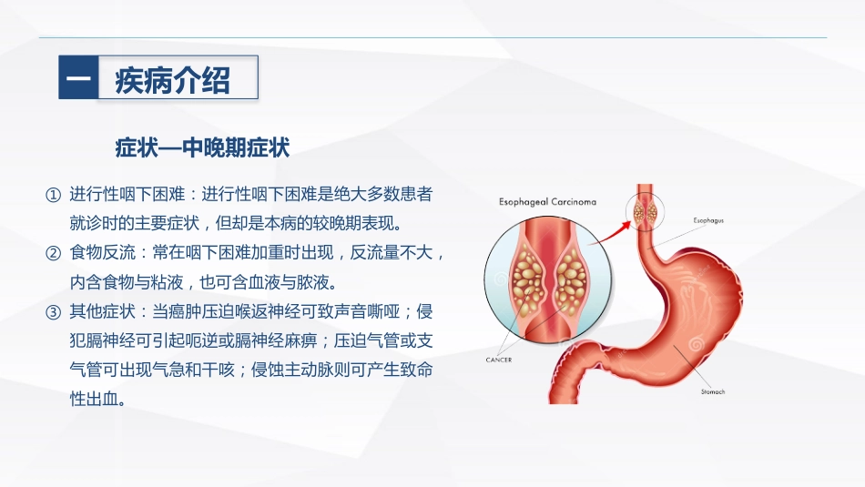 食管癌的护理_第10页